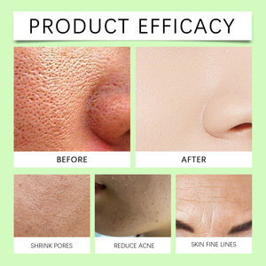 Essence pour affiner les pores, hydrater, estomper les taches, soin quotidien hydratant, rafraîchissant, régulateur de sébum, nettoyant pour l'acné, essence pour compresses humides - Product Image 4