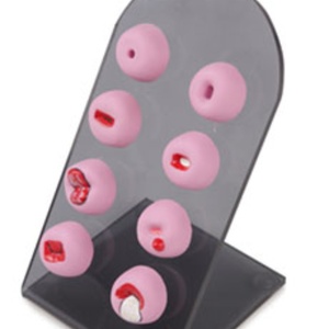 Modelo de Lesiones Cervicales para Ciencias Médicas GP6611 - Product Image 1