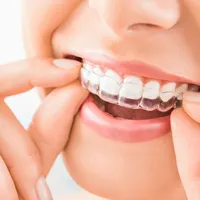 Alisador de dentes em casa, endireitador de dentes alinhadores claros aparelhos invisíveis para alinhamento pessoal