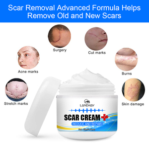 Best Sell Gel per la rimozione delle cicatrici trattamento per l'acne cicatrici sbiancanti crema Gel per la cura crema per il viso a base di erbe per adulti e lozione crema per la vitiligine - Product Image 5