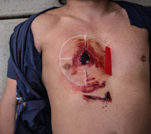 Pansement de premiers soins Joint thoracique d'urgence ventilé à 4 trous avec évent - Product Image 4