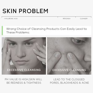 Limpiador Facial de 50g para el Cuidado de la Piel, Espuma Suave y Delicada de Bajo PH con Ácido Hialurónico, Reabastecedor de Hidratación, Venta al Por Mayor - Product Image 2