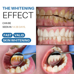 Penna Sbiancante per <span class=keywords><strong>Denti</strong></span> Senza Perossido, 4ml, per <span class=keywords><strong>Denti</strong></span> Sensibili, Uso Domestico, Etichetta Privata, Vendita all'Ingrosso - Product Image 3