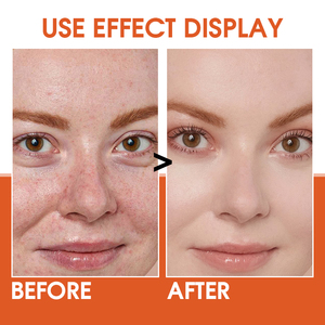 Suero facial para el cuidado de la piel, eliminación de manchas oscuras, reparación y blanqueamiento sin sulfato y vitamina C y coenzima Q10, suero facial de etiqueta privada - Product Image 5