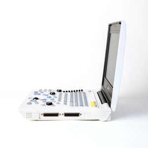 Tierärztliches Ultraschall-Diagnosesystem Schwarz-Weiß Veterinär-Ultraschallscanner mit Konvex-<span class=keywords><strong>Array</strong></span>-Sonde - Product Image 5
