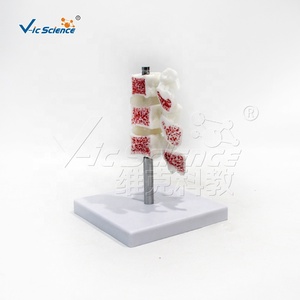 <span class=keywords><strong>Modello</strong></span> Anatomico Deluxe dell'Osteoporosi Umana PreNext con Icone Simili e Sezioni Trasversali - Product Image 6