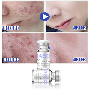 Siero Viso Rassodante al Collagene e Peptidi di Rame Blu con Vitamina <span class=keywords><strong>C</strong></span>, Ampolle Cosmetiche Private Label - Vendita Calda - Product Image 3