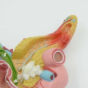Model Pancreas, Duodenum, dan Kandung Empedu Manusia Ukuran Asli KyrenMed dengan Pembuluh Darah & Saraf - Product Image 4