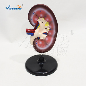 Modèle d'anatomie rénale, modèle de structure rénale humaine, aide pédagogique pour la démonstration en urologie - Product Image 1