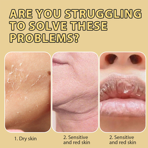 Balsamo al Miele e Sego 60g, <span class=keywords><strong>Crema</strong></span> Viso Naturale Idratante <span class=keywords><strong>per</strong></span> Riparazione della Pelle, Vegana e Biologica <span class=keywords><strong>per</strong></span> Tutti i Tipi di Pelle - Product Image 5