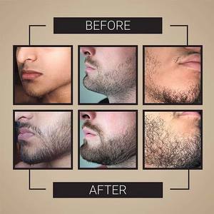 Gummies pour la croissance de la barbe OEM pour hommes, ingrédients naturels favorisant la croissance des poils de la barbe. - Product Image 6