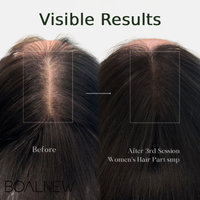 Minyak Rambut Herbal Rosemary Mint Biotin OEM, Serum Penguat Pertumbuhan Rambut, Pencegah Kerontokan, Minyak Esensial Perawatan Rambut, Minyak Penumbuh Rambut