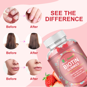Gomitas de biotina de marca privada OEM con colágeno, queratina y vitamina C, suplemento dietético que apoya la salud del cabello, la piel y las uñas. - Product Image 2