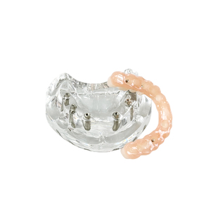 Modelos Dentales de Resina a Precio de Fábrica, Modelos de Implantes Dentales Maxilares y Dentaduras Postizas Reutilizables para Entrenamiento y Uso Educativo - Product Image 5