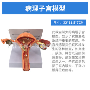 Sistema reproductor femenino humano: modelo anatómico y patológico del útero, la vagina y los ovarios; material didáctico para - Product Image 5