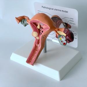 Modelo de Útero Femenino de Alta Calidad, Modelo de Útero Fantómico - Product Image 6