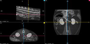 Escáner de Tomografía Computarizada <span class=keywords><strong>Veterinaria</strong></span> para Hospital Veterinario, Sistema de Diagnóstico por Imágenes para Perros, Gatos y Animales Pequeños - Product Image 6