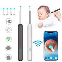 Limpiador de Oídos Visual Inalámbrico con Conexión WiFi, Cámara HD, Recargable por USB-C, Otoscopio Portátil para Limpieza de Cera de Oídos en el Hogar