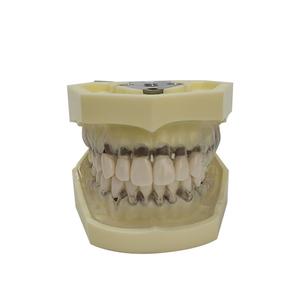 Model penyakit periodalat-alat dengan transparan demografis permen karet vagina ginives - Product Image 1