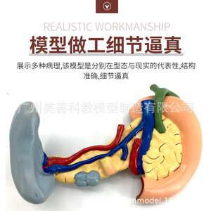 Modèle de simulation pédagogique des tissus pathologiques du pancréas, de la rate, du foie, de la vésicule biliaire et du duodénum ; spécimen pathologique du pancréas - Product Image 1