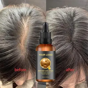 Autres produits contre la perte de cheveux essence de gingembre huile de gingembre perte de cheveux repousse cheveux croissance sérum soins Max oem