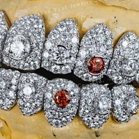 Grillz dentaire personnalisé en argent S925, style Hip Hop, certifié par une tierce partie, bijoux de corps haut de gamme pour hommes et femmes, testé et approuvé