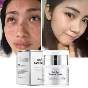 Spring tree black pearl whitening pimple removal dark spot fade rapid white skin whitening cream