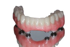 Disco <span class=keywords><strong>PMMA</strong></span> per dente temporaneo rosa doppio strato <span class=keywords><strong>PMMA</strong></span> blocchi di resina per laboratorio dentale materiali Mono multistrato per odontoiatria - Product Image 3