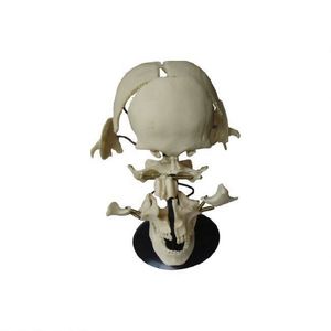 50102.03 Huesos de cráneo - Product Image 1