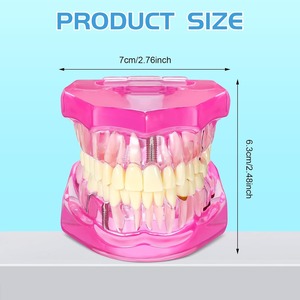Modelo de Dientes para Implantes Dentales con Dientes Removibles, Demostración Patológica de Dientes Estándar para Dentistas, para Navidad - Product Image 2