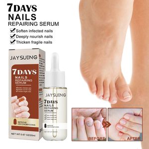 Suero para el Cuidado de las Uñas con Ácido Hialurónico Jaysuing, Tratamiento Efectivo para Hongos en las Uñas en 7 Días, Cuidado de los Pies, Aceite de Menta, Aceite para el Cuidado Corporal - Product Image 3