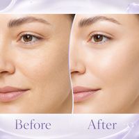 OEM ODM Ampolla de Suero Facial Volufiline de 10 ml, Niacinamida, Ácido Hialurónico, Péptidos, Hidratante, Antienvejecimiento, Venta al por Mayor, Etiqueta Privada