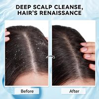 Shampoo exfoliant pour le cuir chevelu à la lavande, soin du cuir chevelu 2 en 1 avec huile de menthe, soin capillaire pour clarifier et éliminer les accumulations
