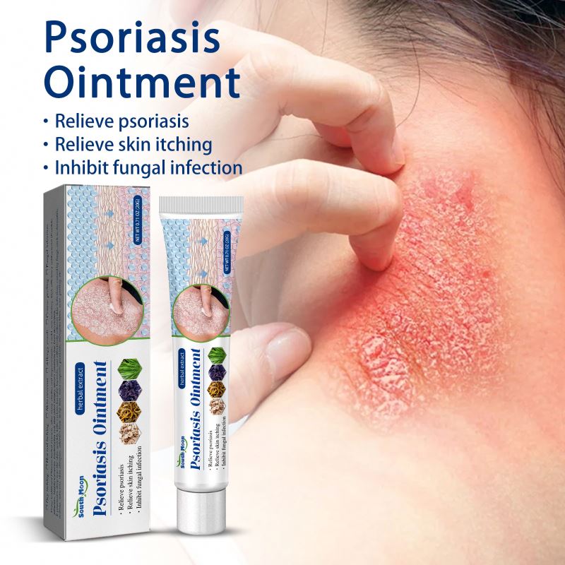 South Moon 20g psoriasis ointment acne dermatitis scrotum eczema pityriasis urticaria psoriasis treatment cream