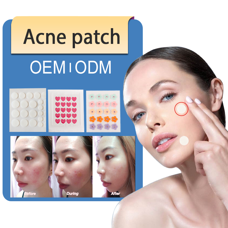 Prival Label Acne Patch for Acne