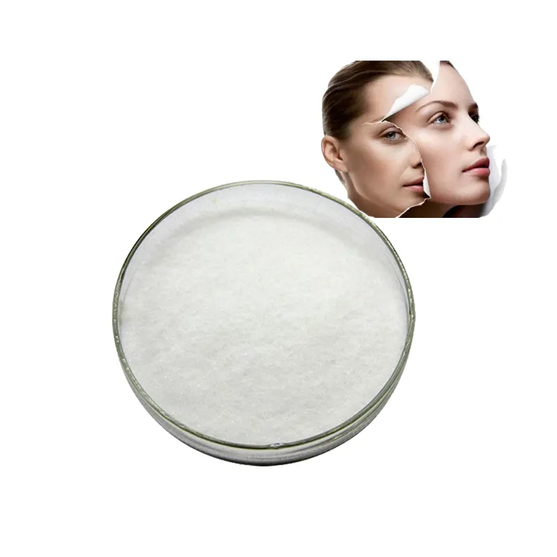 Kwaliteit Cosmetica Kwaliteit Pbp Poeder Monobenzone Powdercas 103 16 2 4-benzyloxyfenol Voor Het Bleken Van De Huid