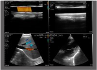 Ecógrafo Portátil 3 en 1 B26G de 192 Elementos, Escáner de Ultrasonido de Mano para Uso Humano, Sonda Inalámbrica