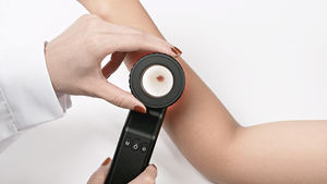 IBOOLO DE-4100 Dermascopic elektronik medis, untuk penyakit kulit berpigmen penyakit dermatoskop - Product Image 6