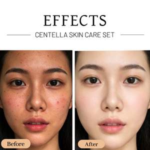 Etiqueta privada 4 Uds productos para el cuidado de la <span class=keywords><strong>piel</strong></span> Centella Mucin colágeno limpiador facial suero crema hidratante Facial conjunto de cuidado de la <span class=keywords><strong>piel</strong></span> - Product Image 4