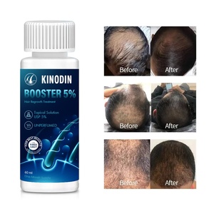 KINODIN Suero de Crecimiento Súper Rápido del Cabello, Tónico 5%, Extracto de Jengibre Orgánico, Evita La Pérdida de Cabello, Suero de Crecimiento Xinoxin Xeroxin, Rusia, 60ml - Product Image 6