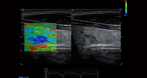 Ecógrafo Veterinario Doppler Color Digital Sonoscape P25 Elite con Pantalla LED de Alta Definición de 23.8 Pulgadas para Departamentos Generales - Product Image 5