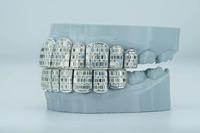 Grillz pour hommes en argent sterling poli, design personnalisé Gallerley, tendance HipHop, taille princesse, moissanite VVS