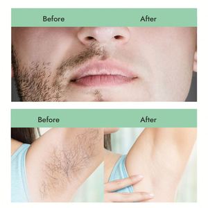 Meilleure vente 300g cire molle pâte à sucre Kit professionnel épilation indolore cire de sucre pour femmes/hommes - Product Image 4