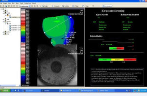 Equipo Oftalmológico de Alta Calidad SW-6000 Topografía Corneal - Product Image 6