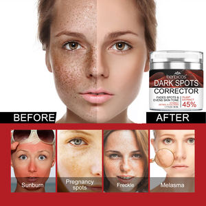 Herbicos Fade Face Dark Spot Blemishes Corrector Remover Private Whitening Hidratante Facial y Body Freckle Remover Cream - Product Image 4