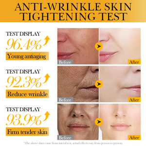 Mascarillas Faciales Hidratantes y Calmantes de Cúrcuma SADOER de Alta Calidad OEM, <span class=keywords><strong>Mascarilla</strong></span> Coreana Personalizada Antioxidante e Hidratante <span class=keywords><strong>para</strong></span> <span class=keywords><strong>Piel</strong></span> Propensa al Acné - Product Image 5