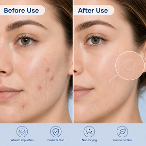 CL Cerotti Idrocolloidali Coreani Personalizzati Invisibili con Acido Salicilico per Acne e Brufoli, Migliori Cerotti Rotondi Carini Anti-Acne per Tutto il Viso - Product Image 2