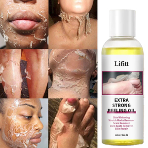 Meilleure Vente Huile Exfoliante <span class=keywords><strong>Anti</strong></span>-Âge et <span class=keywords><strong>Anti</strong></span>-Vergetures, Sérum Visage, Lotion Éclaircissante pour le Soin de la Peau, Essence Faciale pour le Visage - Product Image 3