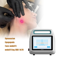 Appareil de lifting facial endolifting mini-invasif 980nm 1470nm pour raffermissement et amincissement du visage
