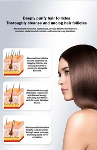 Sistema de Terapia para la Alopecia en Salones de Belleza, Consulta al Cliente, Análisis, Mejora la Circulación Sanguínea, Máquina para la Regeneración de Folículos Pilosos - Product Image 6
